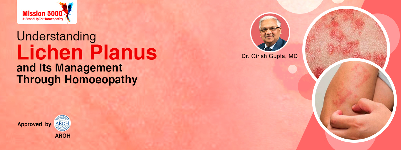 Understanding Lichen Planus and its Management Through Homoeopathy