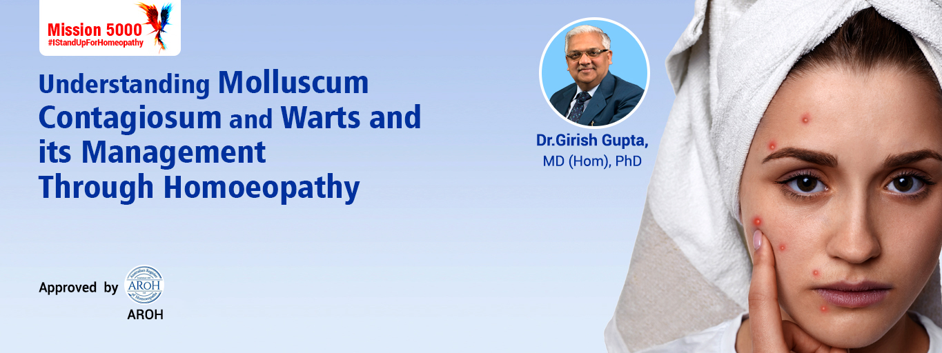 Understanding Molluscum Contagiosum and Warts and its Management Through Homoeopathy