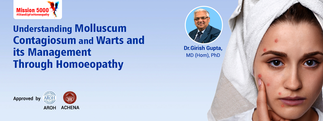 Webinar On Understanding Molluscum Contagiosum And Warts And Its
