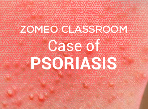 Case of Psoriasis