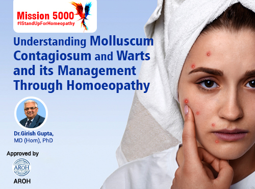 Understanding Molluscum Contagiosum and Warts and its Management Through Homoeopathy