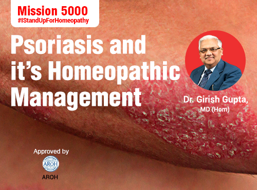 Psoriasis and Homeopathic Management