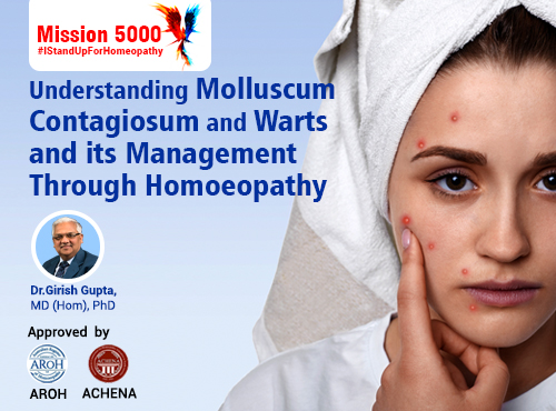 Understanding Molluscum Contagiosum and Warts and its Management Through Homoeopathy